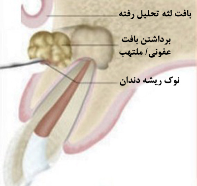 i2