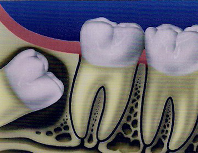 i4